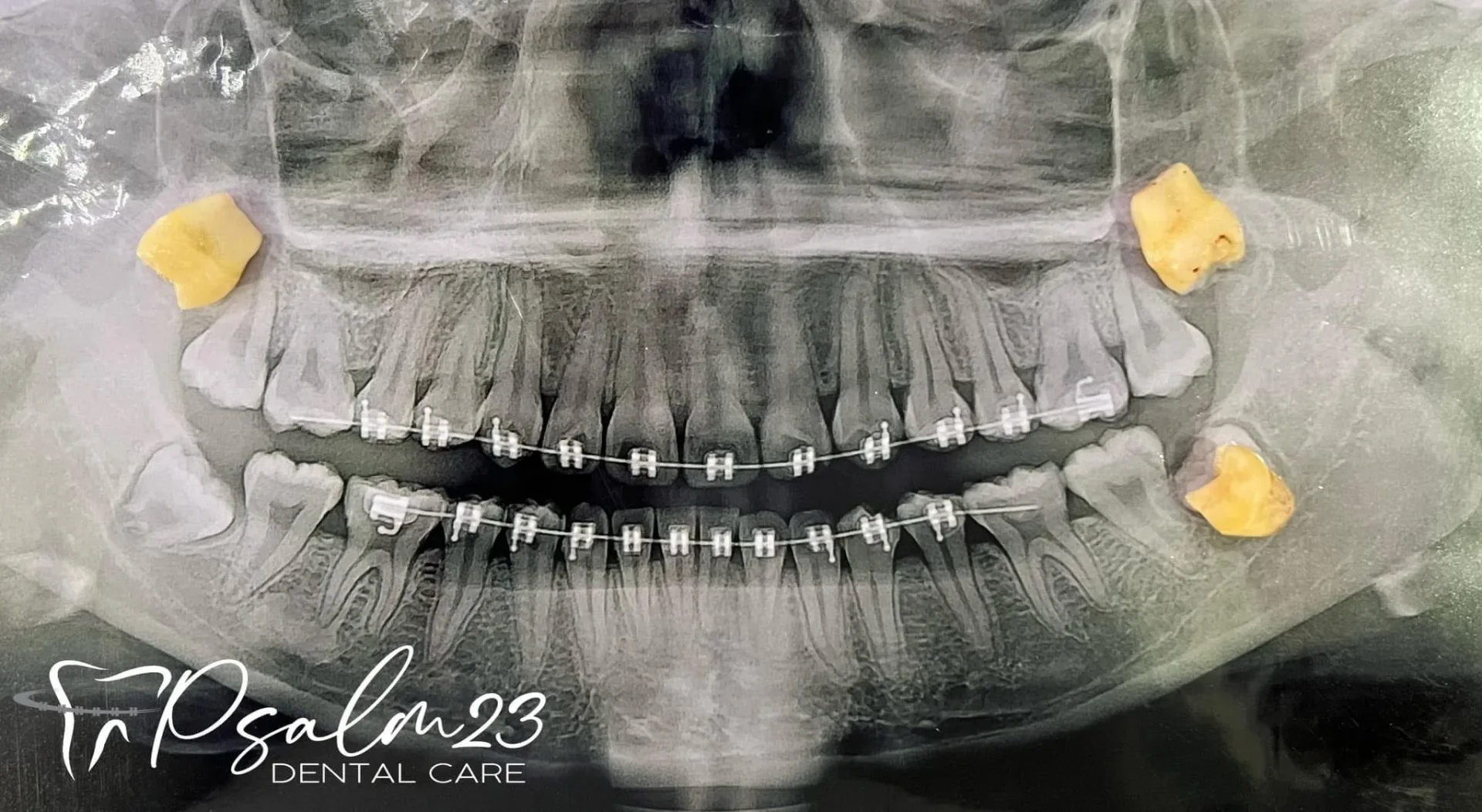 Psalm23 Dental Care oral surgery services — photo 2